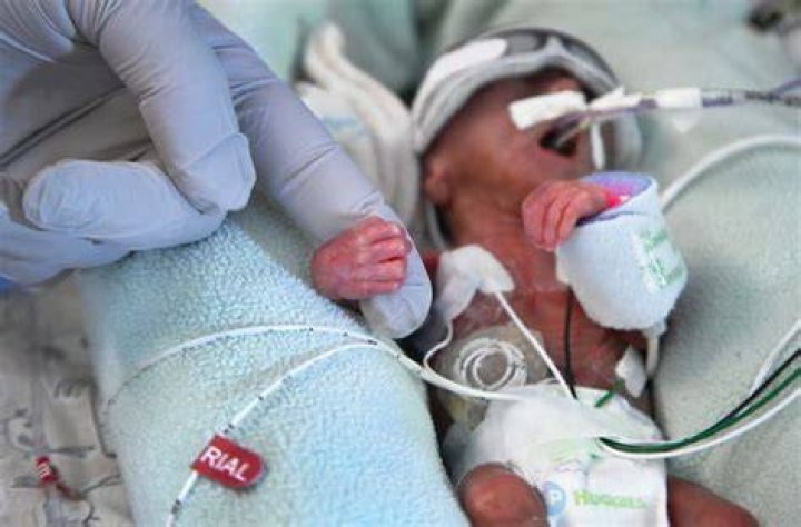 Birth prematurely