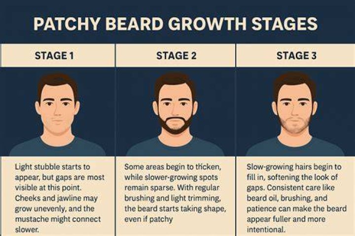 patchy beard growth